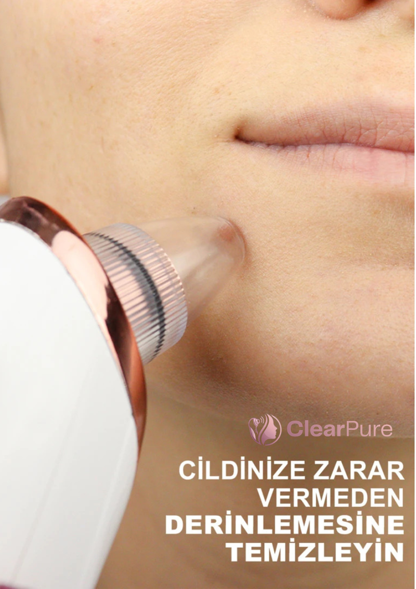 ClearPure™ Vakumlu Siyah Nokta ve Cilt Temizleyici