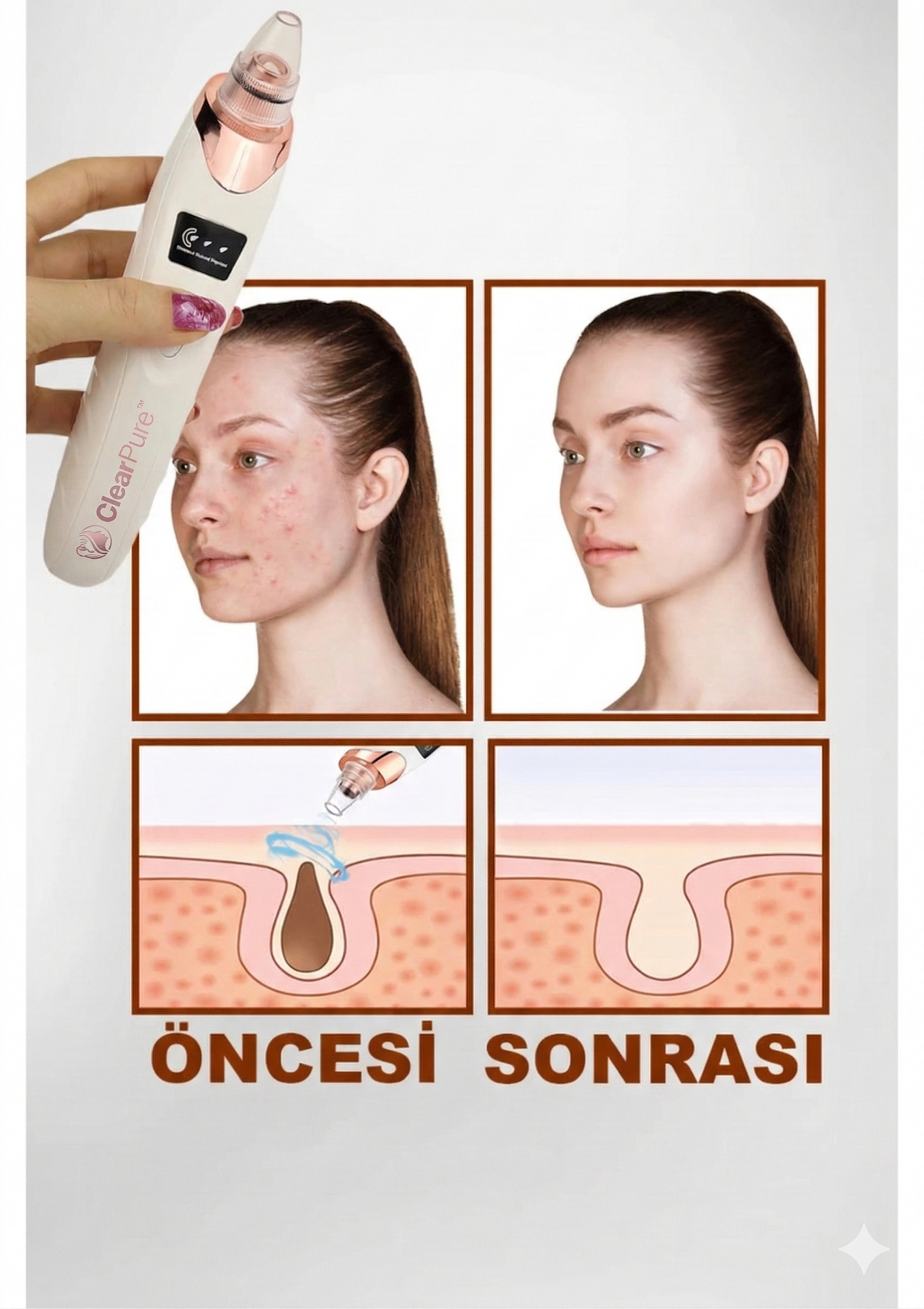 ClearPure™ Vakumlu Siyah Nokta ve Cilt Temizleyici